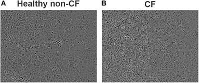 Use of a Primary Epithelial Cell Screening Tool to Investigate Phage Therapy in Cystic Fibrosis